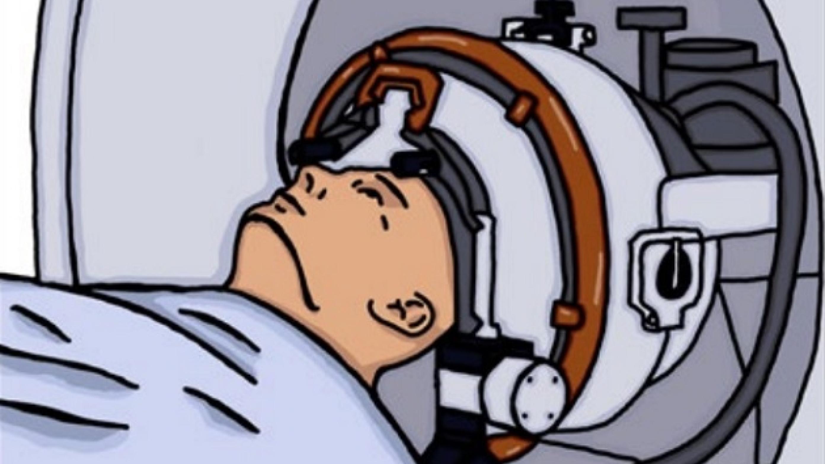 Skematisk tegning af patient-MR-skanner med påspændt fokuseret ultralydapparat. Illustration: Mikkel Schou Andersen