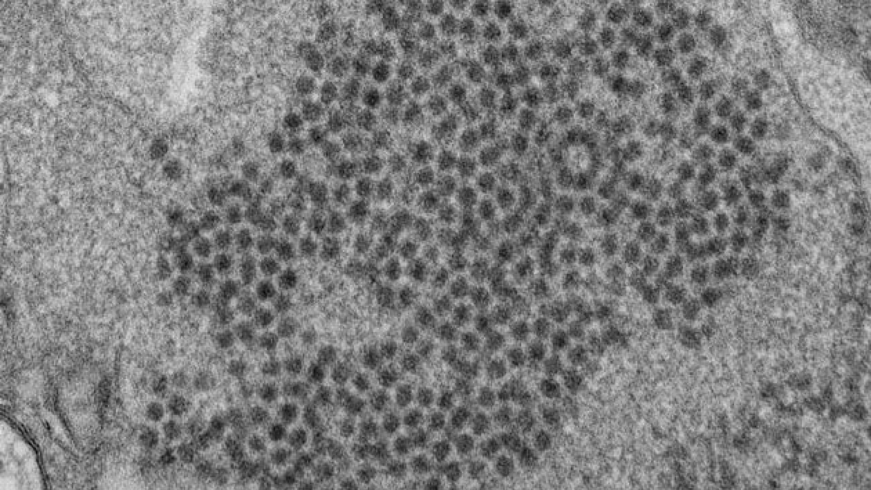 Enterovirus D68. (Foto: CDC)