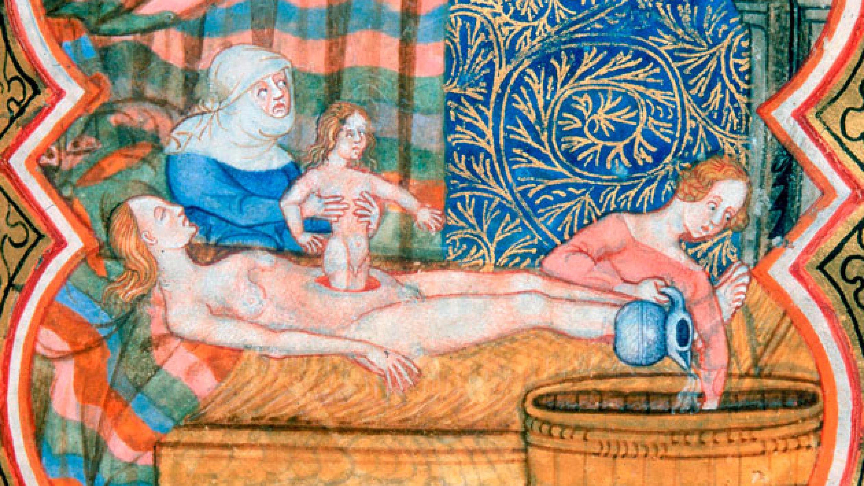 Kejsersnit. Illustration: British Library fra 1400-tallet