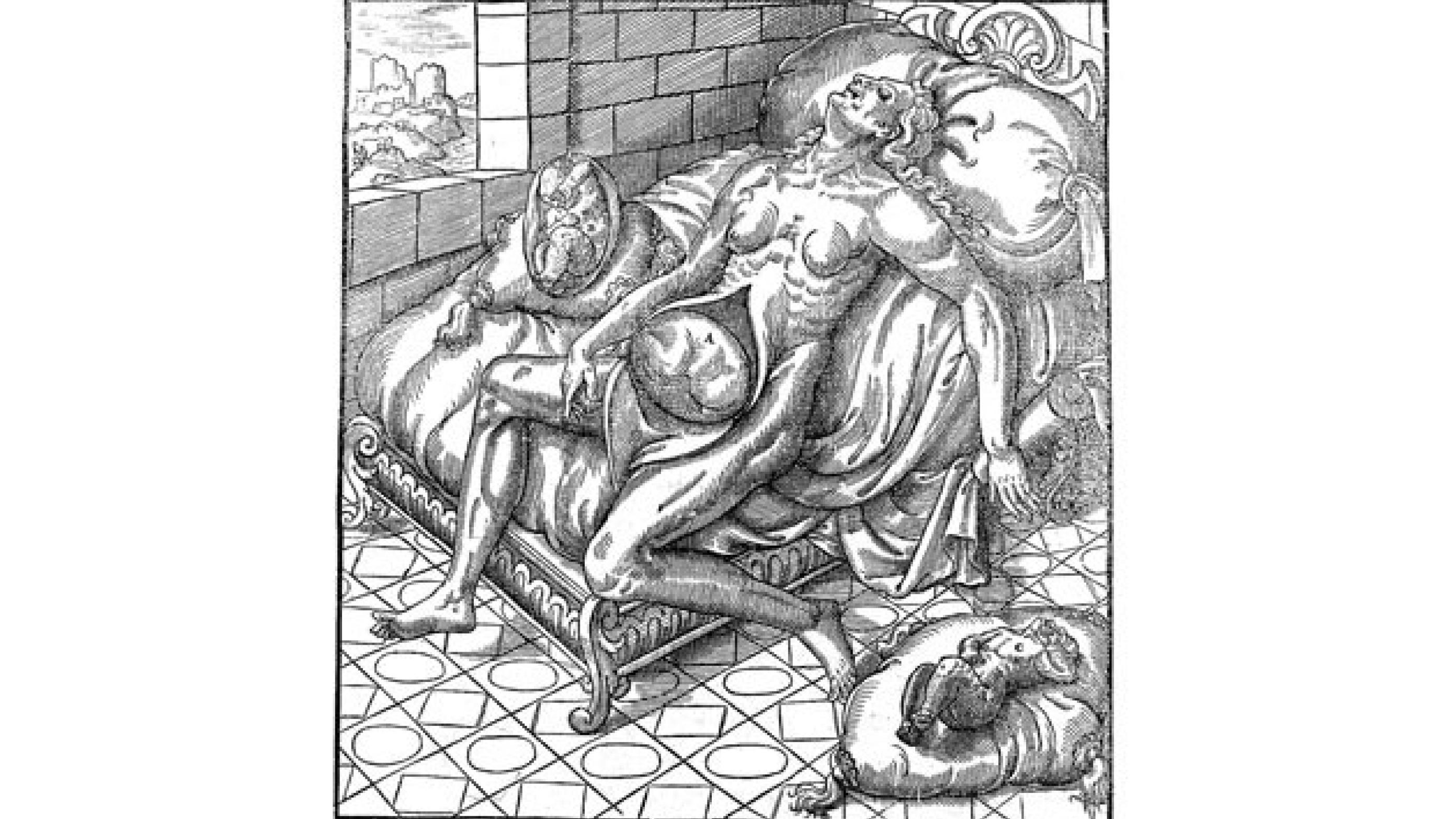 Illustration fra den første kasuistik om udtagelsen af et »stenbarn« i Frankrig, 1582. Træsnit af Joannes Albosius. The Wellcome Collection.