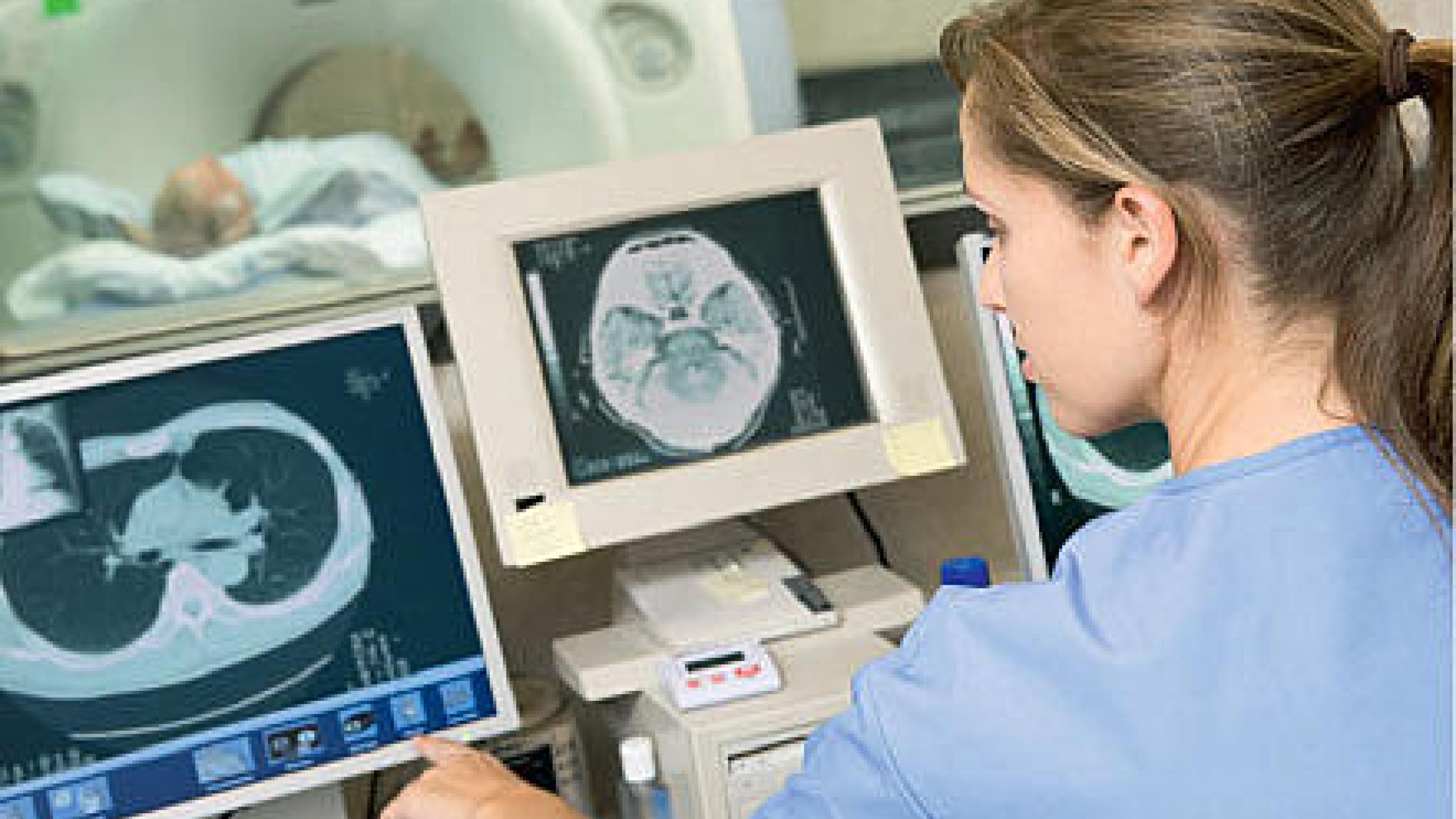Straight-to-test computed tomography from primary care to fast-track reduces chest-physician time.