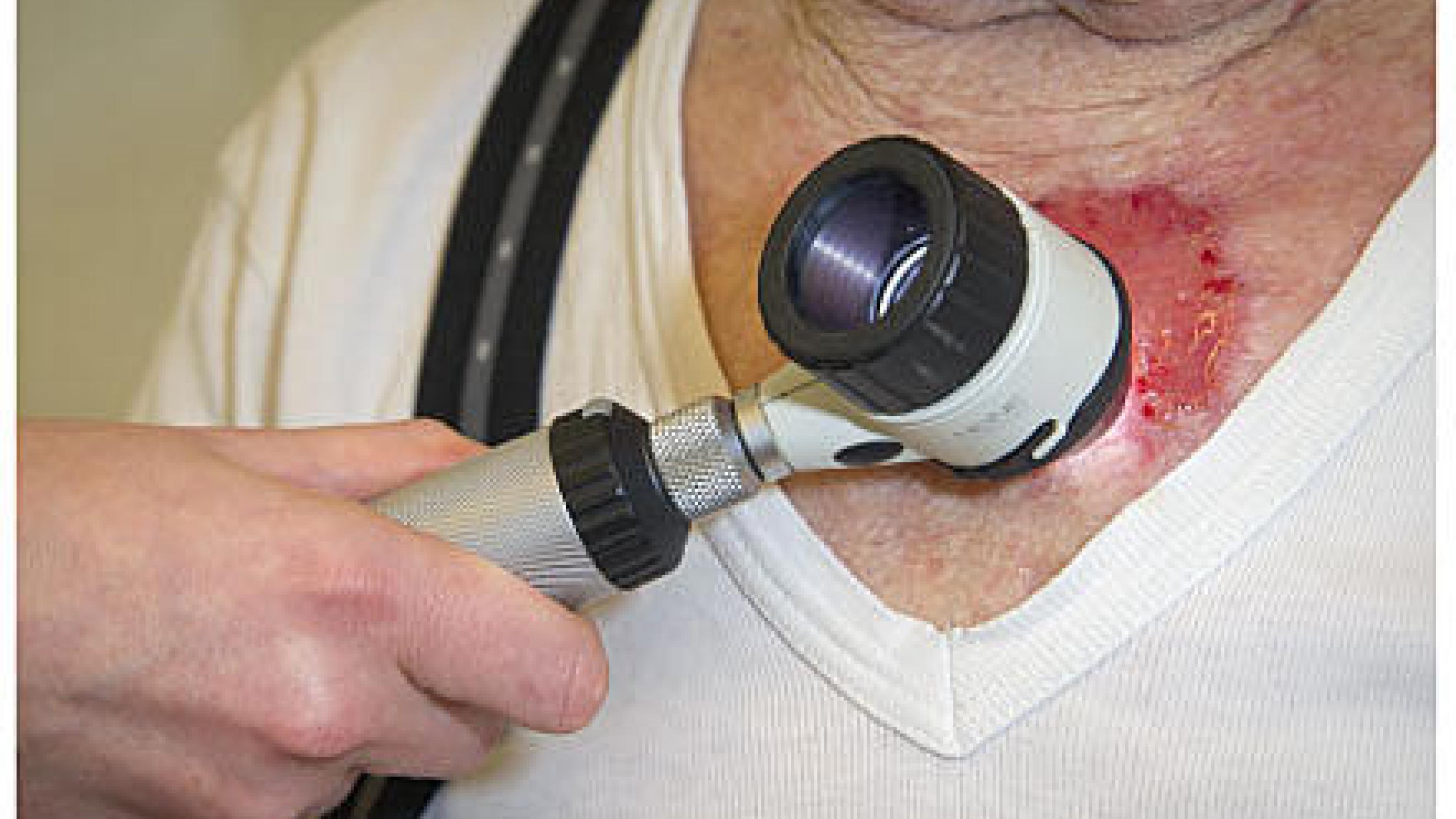 Skin cancer patients typically attend follow-up for several years after treatment. Photo: Karsten Kanding Christrup.