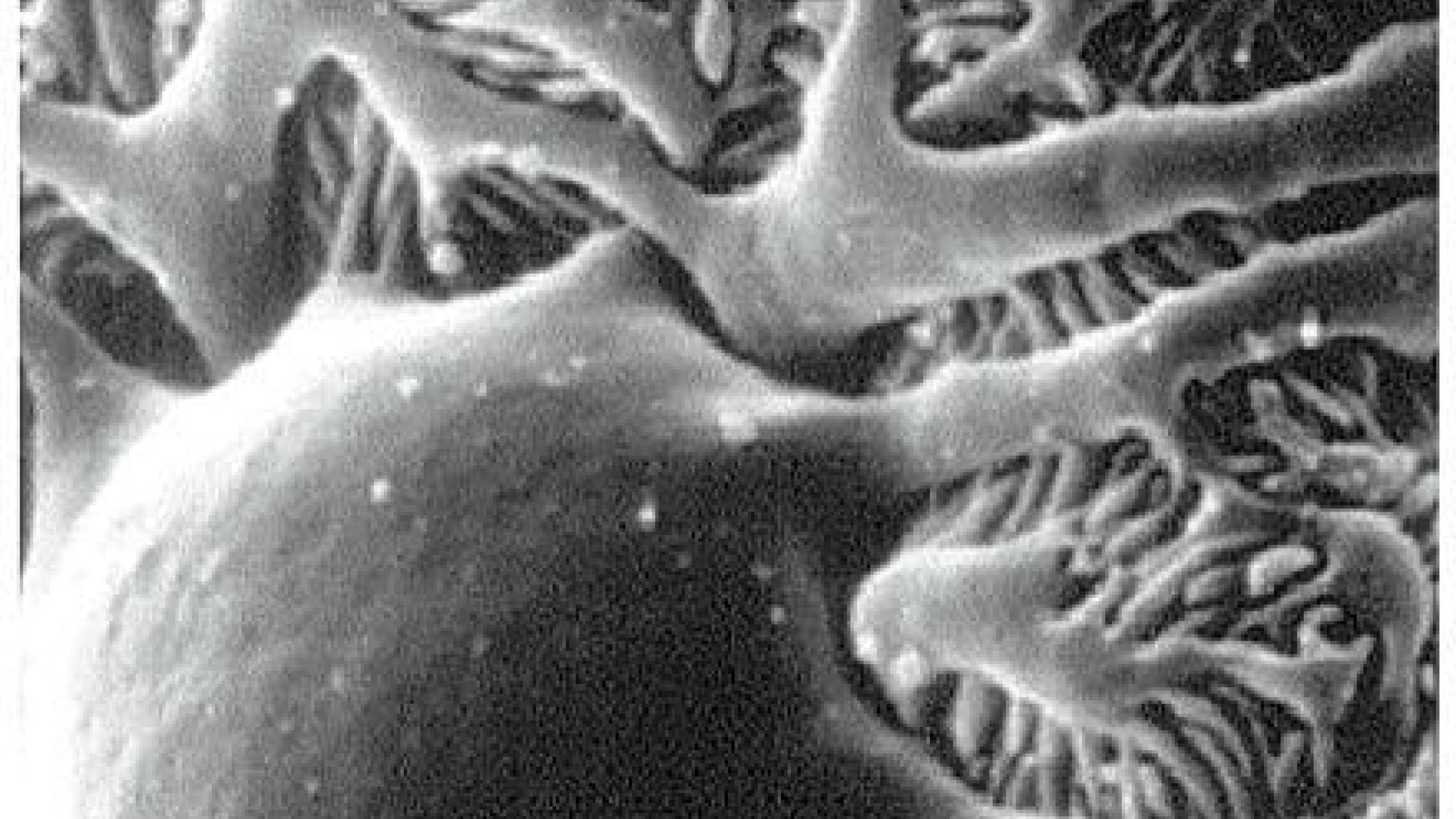 Elektronmikroskopisk billede af glomerulus.