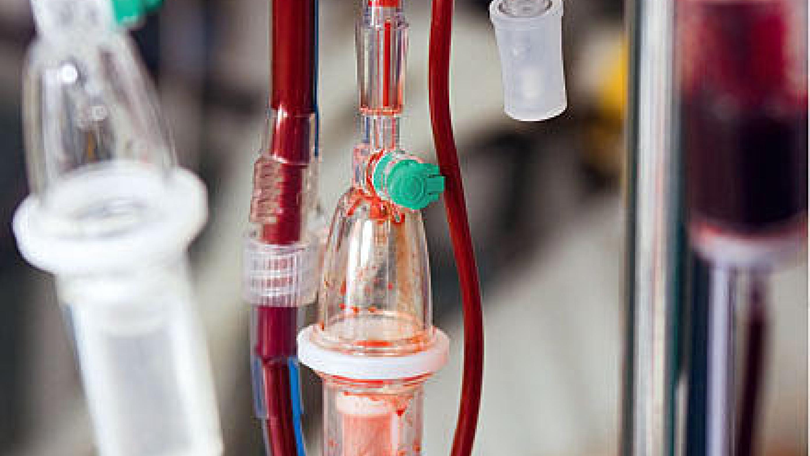 Blodtransfusion indgår i den akutte håndtering af alvorlig blødning hos patienter, der er i antikoagulansbehandling, men kendskab til reversering er en forudsætning for korrekt behandling.