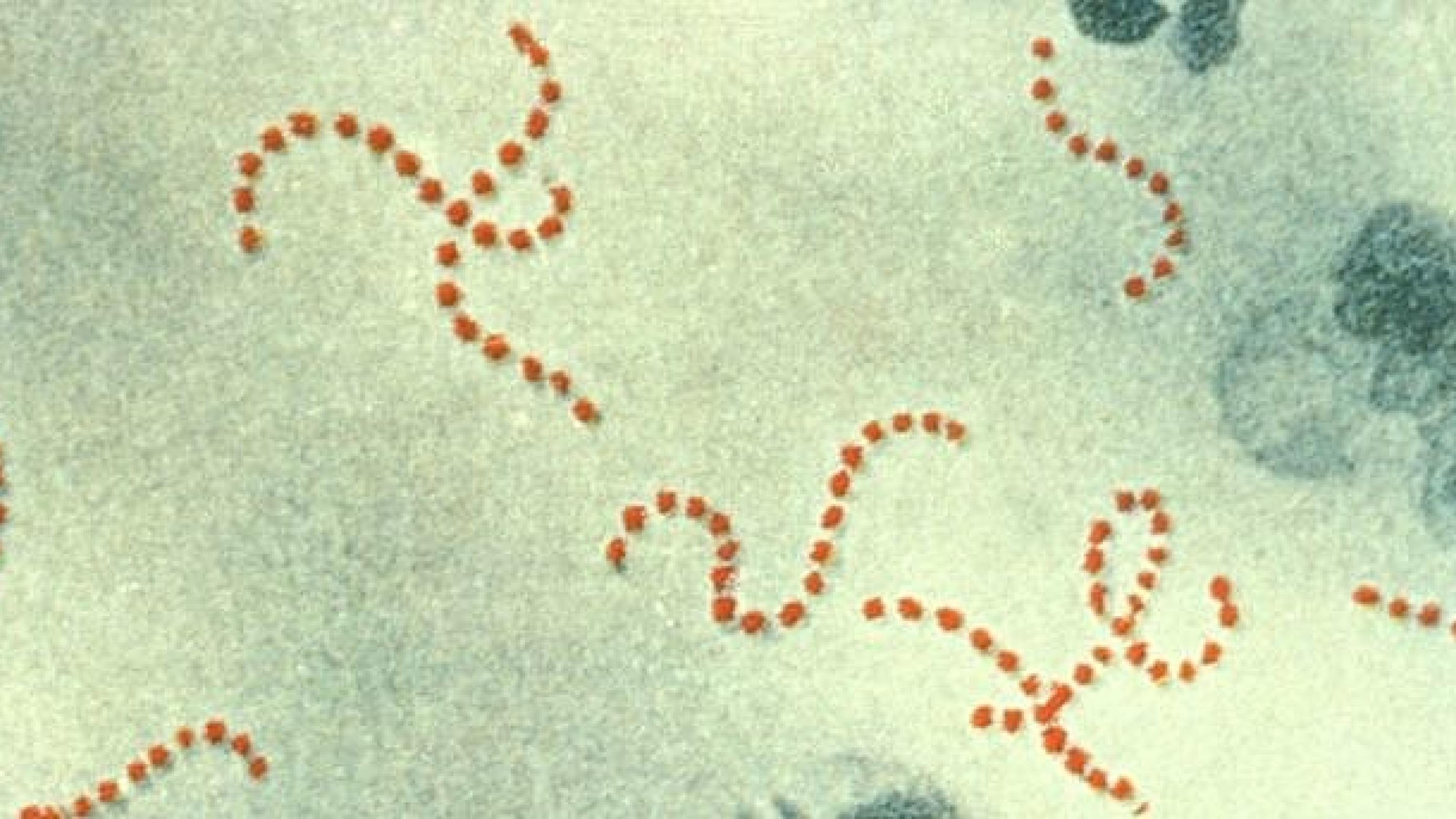 Streptococcus pyogenes. Foto: Wikimedia