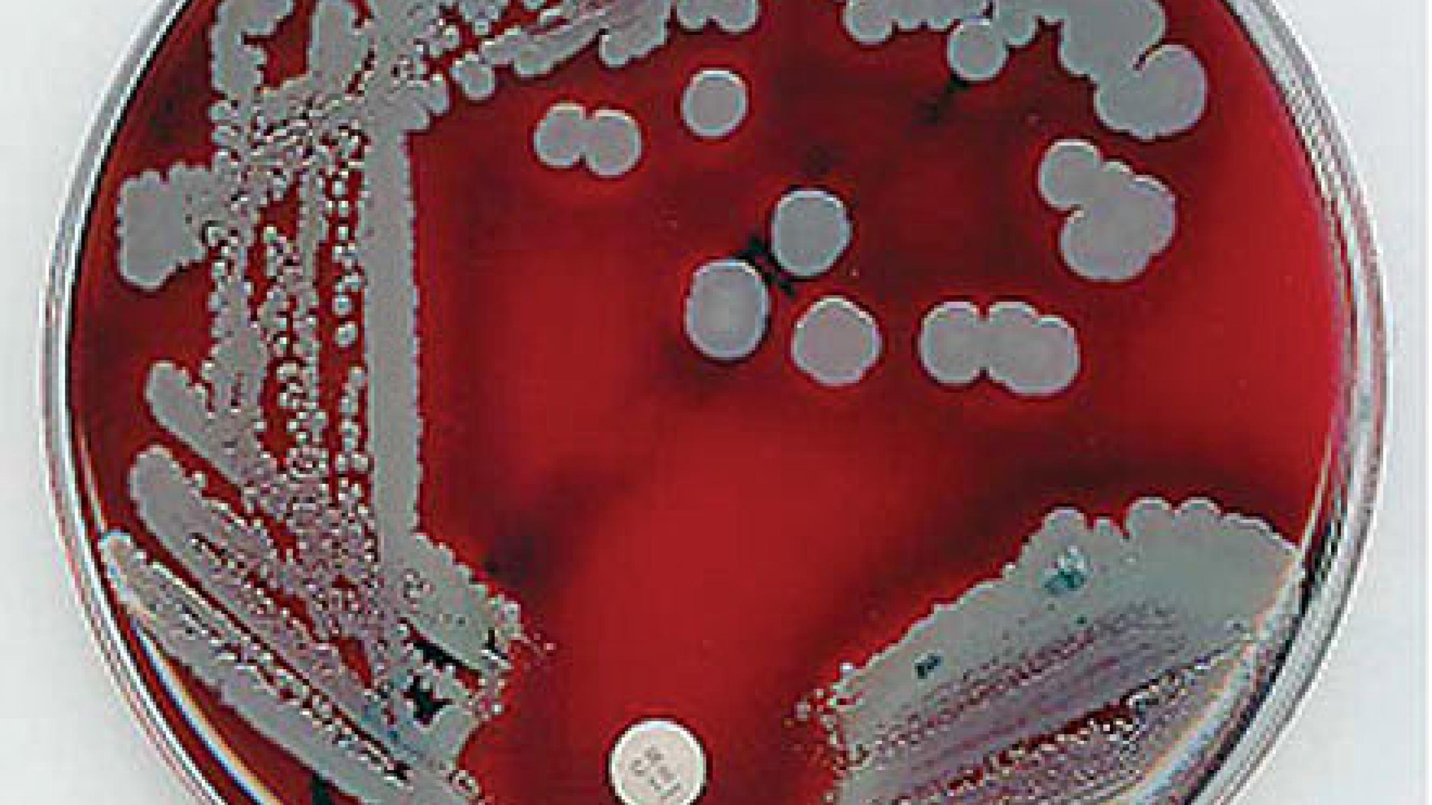 Staphylococcus aureus på blod­agar med intakt følsomhed for gentamicin (fra www.flickr.com/photos/estherase/ 34165928/).