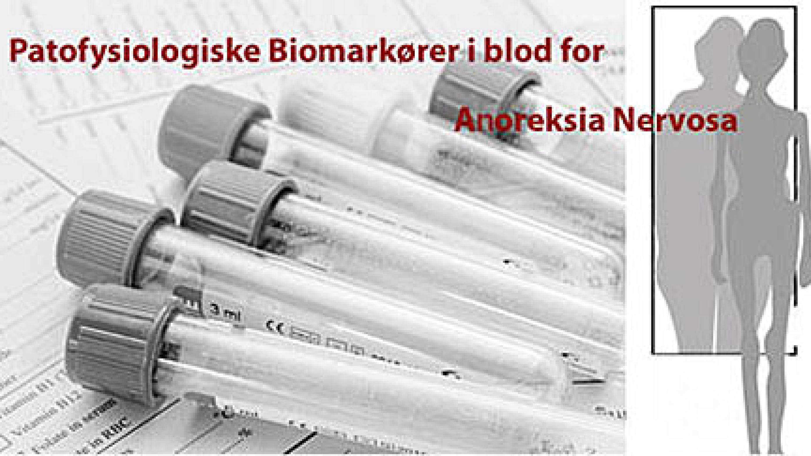 Patofysiologiske biomarkører i blod for anorexia nervosa.