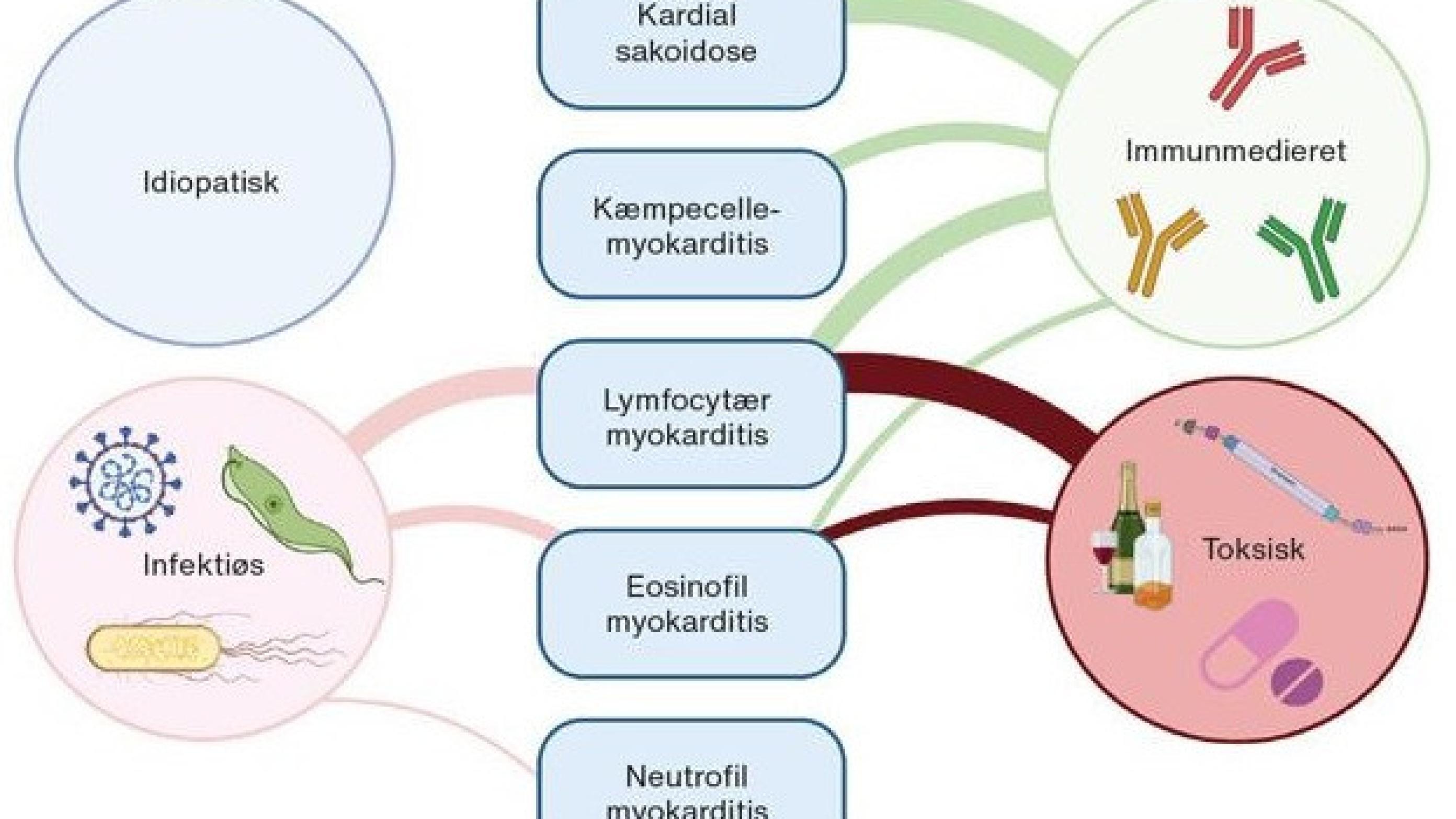 Figur 1 Hyppigste årsager til myokarditis i relation til histologiske karakteristika.
